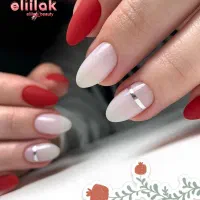 کاشت و ترمیم ناخن تضمینی