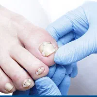 درمان بیماری ناخن ساختمان پزشکان رز پیروزی ۳۸