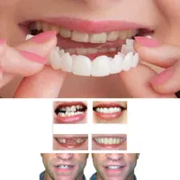 لمینت متحرک دندان