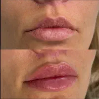 خدمات همواره تخفیفی 400/500