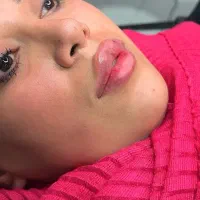 کیلینک زیبایی پاستور تخصصی ترین کیلینک زنجان|خدمات آرایشگری و زیبایی|زنجان, |دیوار