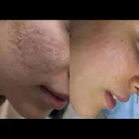 پزشکی آف ویژه|خدمات آرایشگری و زیبایی|بروجرد, |دیوار