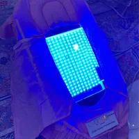 اجاره دستگاه فتوتراپی در منزل