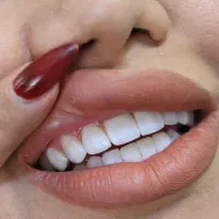 تخفیف ویژه ۲۰٪خدمات دندانپزشکی|خدمات آرایشگری و زیبایی|شیراز, ارم|دیوار