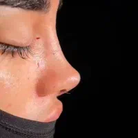 عمل جراحی زیبایی