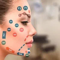 آموزش فیلر ژل بوتاکس نخ لیفت لیزر مو فشیال حجامت|خدمات آموزشی|اصفهان, هزارجریب|دیوار