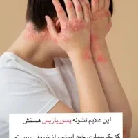 سرم درمان پسوریازیس واگزما