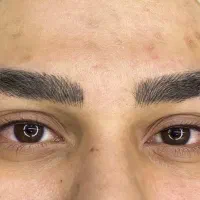 میکروبلیدینگ.در بستان اباد1180تومان با پرمابلند