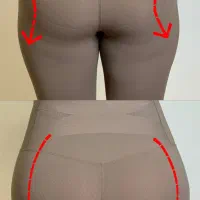 فیلربادی با تخفیف ۵۰٪در کلینیک مهرزاد|خدمات آرایشگری و زیبایی|تهران, جردن|دیوار