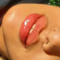 فیلر و بوتاکس تخفیف شب یلدا|خدمات آرایشگری و زیبایی|قم, باسکول|دیوار