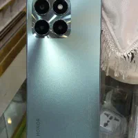 هونور x5 اقساطی بدون چک ، بازنشستگان ، عصر موبایل