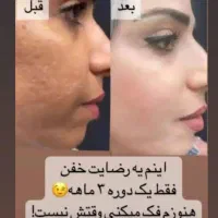 صابون روشن کننده و لایه بردار و کرم مرطوب کننده|آرایشی، بهداشتی، درمانی|سمنان, |دیوار
