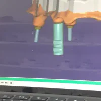 پکیج آموزش طراحی دیجیتال دندان Exo cad