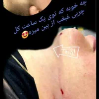 جشنواره تابستان عمل زیبایی|خدمات آرایشگری و زیبایی|قم, باجک دو|دیوار