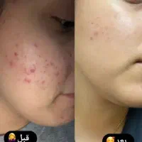 کرم ترمیم کننده گاتیو|آرایشی، بهداشتی، درمانی|تهران, تهرانسر غربی|دیوار