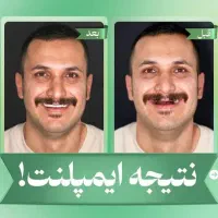 دندانپزشکی اقساط لمینت ایمپلنت و کلیه خدمات دندان|خدمات آرایشگری و زیبایی|مشهد, سجاد شهر|دیوار