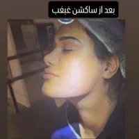 تخفیف عمل بینی لیفت رفع غبغب لیپو ابدو دایرکت ابرو|خدمات آرایشگری و زیبایی|قم, شاه ابراهیم|دیوار