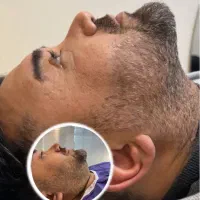 جراحی زیبایی با قیمت فوق العاده مناسب|خدمات آرایشگری و زیبایی|ساری, |دیوار