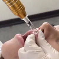 اموزش تزریق ژل بدون سوزن با دستگاه و ۵ اموزش دیگر