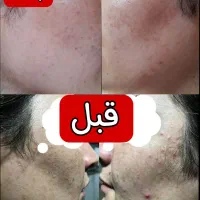 کرم معجزه جوانی|آرایشی، بهداشتی، درمانی|گرگان, |دیوار