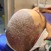 فول تراکم ترین کاشتمو ایران