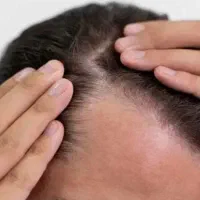 تونیک تقویت مو