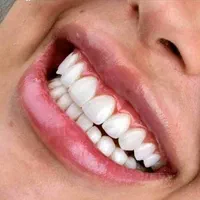 دندانپزشکی زیبایی و درمان با تخفیف ویژه افتتاحیه|خدمات آرایشگری و زیبایی|کرج, اصفهانی‌ها|دیوار