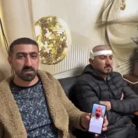 کلینک تخصصی کاشت مو تبریز