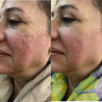 کلینیک تخصصی پوست و مو شایلین