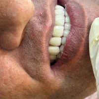 یلدا با تخفیف کامپوزیت|خدمات آرایشگری و زیبایی|ارومیه, |دیوار