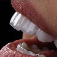 دندانپزشکی و ایمپلنت و کامپوزیت و ارتودنسی|خدمات آرایشگری و زیبایی|سرپل ذهاب, |دیوار