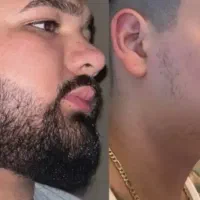 معجزه قرن