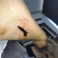 طب سنتی زالو درمانی و حجامت|خدمات آرایشگری و زیبایی|اهواز, گلستان|دیوار