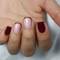 کاشت و ترمیم ناخن