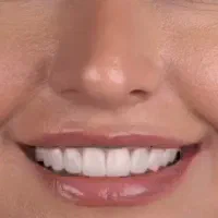 دندانسازی رفیعی|خدمات آرایشگری و زیبایی|اصفهان, بهارستان|دیوار