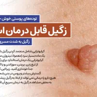 زیگیل