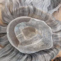 پروتز مو|خدمات آرایشگری و زیبایی|فردیس, طالقانی|دیوار