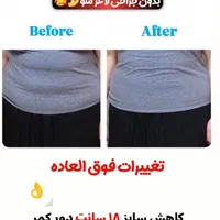 بوتاکس ژل آنزیم نخ لاغری بوتاکس 650 ژل اودری 450|خدمات آرایشگری و زیبایی|قم, باغ شازده|دیوار