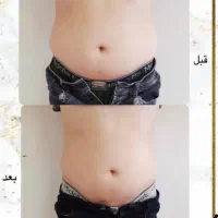 لاغری با دستگاه‌های پیشرفته و زیر نظر پزشک|خدمات آرایشگری و زیبایی|کرج, برغان|دیوار
