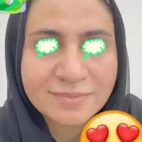 فرمول سفید کننده تضمینی صد درصد طی سه روز نتیجه