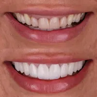 جشنواره شگفتی مطب دندانپزشکی|خدمات آرایشگری و زیبایی|مشهد, احمدآباد|دیوار