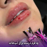 جشنواره مدلینگ ۱۰ سی سی امروز۳۳۰۰فیلر لب لیفت ابرو|خدمات آرایشگری و زیبایی|تهران, مرزداران|دیوار