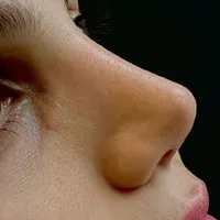 عمل جراحی بینی با تخفیف ویژه در فستیوال تابستانه|خدمات آرایشگری و زیبایی|تهران, فلسطین (میدان انقلاب)|دیوار