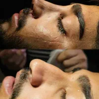 آف عمل زیبایی بینی دراهوازفقط با۲۵تومن ولیفت سینه