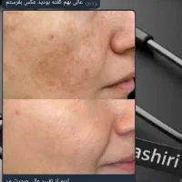 روغن های معجزه گر کاژان|آرایشی، بهداشتی، درمانی|تاکستان, |دیوار