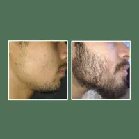 روغن 39روزه|آرایشی، بهداشتی، درمانی|کرمانشاه, |دیوار