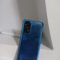شیائومی Redmi Note 11S با حافظهٔ ۱۲۸ گیگابایت