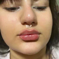 انجام خدمات زیبایی و جوانسازی