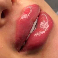 ژل بوتاکس زیبایی مراقبت پوستی
