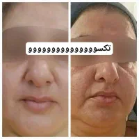 مثل کره چربی سوزی کن|آرایشی، بهداشتی، درمانی|مشهد, دانشجو|دیوار